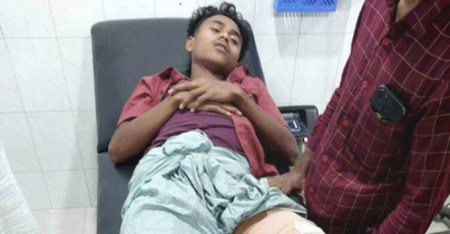 চোরাই পণ্য লেনদেন করতে গিয়ে গুলিবিদ্ধ দুই যুবক