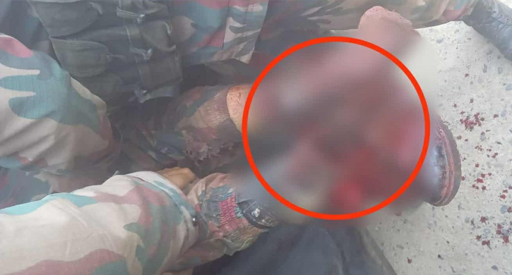 সীমান্তে মাইন বিস্ফোরণে বিজিবি সদস্যের পা বিচ্ছিন্ন সীমান্তে মাইন বিস্ফোরণে বিজিবি সদস্যের পা বিচ্ছিন্ন